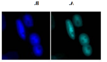 VU‐1免疫染色与PABPN1聚集物在人成肌细胞中共定位